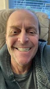 Recovery Journey After Bionic Smile Procedure