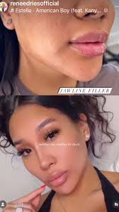 Renee Dries (@reneedriesofficial) • Instagram photos and videos