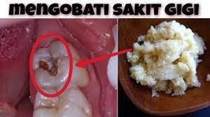 Pada beberapa orang, nyeri muncul ketika. Cara Mengobati Sakit Gigi Berlubang Youtube