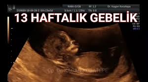 14 gebelik haftasi icinde 3 aylikta bebek ultrasonda nasil gorunur bebek ultrason 3 aylik bebek bebek