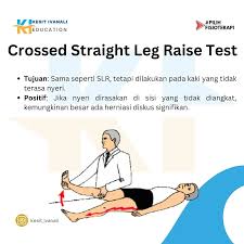 Image result for Crossed-Leg Test