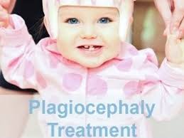 Fundraiser by MaryAnn Svoboda : Baby Helmet for Aria