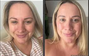 Hi , any suggestion for a collagen supplement for over 50 please 🙏