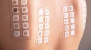 Image result for Patch Testing