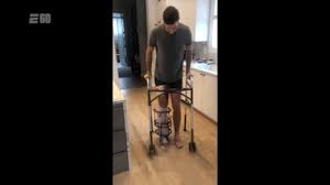 Alex smith understands dak prescott's injury woes | sports. Alex Smith Injury Leg Graphic How We Became Obsessed With Gruesome Sports Injuries Grandstand Central