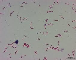 Tracking cre in the united states; Darmbakterium Clostridium Ramosum Fordert Die Entstehung Von Ubergewicht Innovations Report