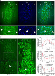 Ge14map is the nation's foremost interactive map providing the public with a visual representation of malaysia's. Retrograde Nerve Growth Factor Signaling Modulates Tooth Mechanical Hyperalgesia Induced By Orthodontic Tooth Movement Via Acid Sensing Ion Channel 3 International Journal Of Oral Science