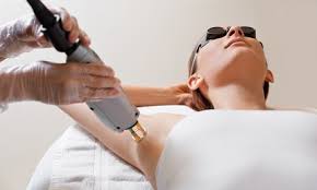 You can prepare for laser hair removal by not waxing or plucking hairs in the treatment area for 4 to 6 weeks before your treatment; Three Laser Hair Removal Sessions At Kp Aesthetics Up To 71 Off Four Options Available Discount Coupon Code Upcomingevents Com