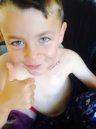 Cole Taylor from Blyth, who has a rare heart condition