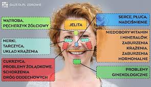 Zespół aspergera (inaczej za lub as od syndromu aspergera) jest to całościowe zaburzenie rozwoju o podłożu neurologicznym, które zalicza się do tzw. Kraza Mapki Z Chorobami Wypisanymi Na Twarzy Nauka Czy Szarlataneria