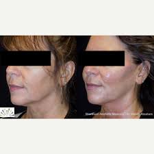 Wendy Abraham, ND Reviews, Before and After Photos, Answers