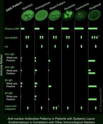 Image result for ANA Staining Pattern