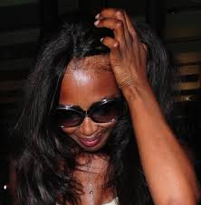 What causes thin or damaged hair edges? Re Grow Thinning Edges