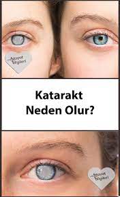 Katarakt Neden Olur Saglik Dogal Tedaviler Beslenme