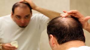 Dan obat ramun rontok di apotik ini digunakan dengan cara dituangkan sedikit pada telapak tangan, busahan & usapkan pada kulit kepala. Cara Mudah Atasi Rambut Yang Rapuh Dan Mudah Rontok Tribunnews Com Mobile