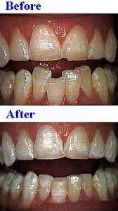 Damion cooper, dmd | rosewood dental in germantown, md germantown maryland dentist, damion cooper makes an impact on the world of cosmeti. Cosmetic Dentistry Wikipedia