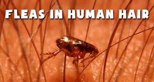 How to get rid of fleas on humans skin. Fleas In Human Hair Symptoms How To Stop This Menace