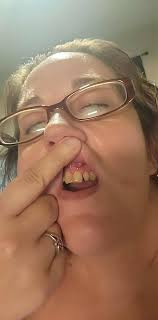 Has anyone had experience with Dr Mario Montoya for porcelain veneers?