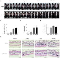 Image result for HAIR Score