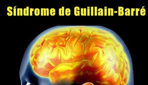 Puede causar debilidad muscular y parálisis. Sindrome De Guillain Barre Espana Photos Facebook
