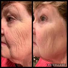 Pregnant skin care products with no retinol