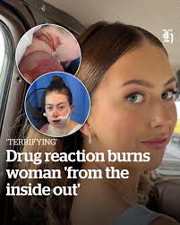 It was scary, I guess, hearing ... 'okay, no one really knows a lot about  this'."