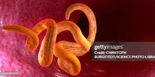 Image result for Pinworm