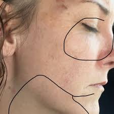 Fundraiser by Erin Michele : Trying to escape: Cali said to get home to be  safe. e