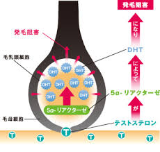 Aga 男性型府脱毛症 の原因 帯広でaga 薄毛治療は帯広中央クリニック