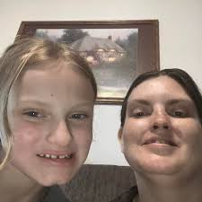 Motorcycle and vehicle accident