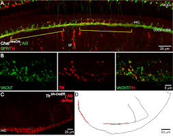 Check spelling or type a new query. Sound Exposure Dynamically Induces Dopamine Synthesis In Cholinergic Loc Efferents For Feedback To Auditory Nerve Fibers Elife