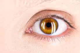 Common symptoms of this problem—referred also as corneal abrasion include pain, tear overproduction, sensitivity to light, and squinting. Cat Scratched My Eye Now What Can I Prevent This Feline Follower