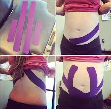 Pin On Kinesiology Tape Pregnancy