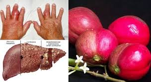 Cara konsumsinya cukup mudah, yaitu hanya dengan merebus buah dari mahkota dewa yang sudah kering dan konsumsi 2 kali sehari untuk hasil yang maksimal. Khasiat Buah Mahkota Dewa Untuk Lelaki Belajar Agribisnis