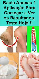 basta 1 aplicacao anoite e adeus rachaduras nos pes com pasta de dente em 2020 dicas de cuidados com as unhas listerine para os pes rachaduras nos pes
