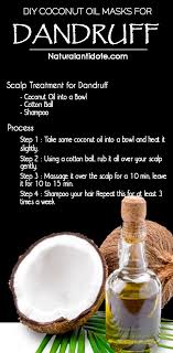 Coconut Oil For Dandruff And Itchy Scalp Naturalantidote Com Coconut Oil Hair Mask Diy Coconut Oil Hair Coconut Oil For Dandruff