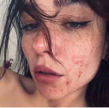 Use your money chop better thing sometimes, problem no dey finish.