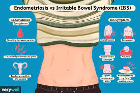 The Differences Between Endometriosis And Ibs