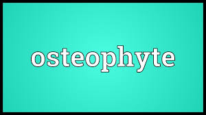 Entdecke rezepte, einrichtungsideen, stilinterpretationen und andere ideen zum ausprobieren. Osteophyte Meaning Youtube