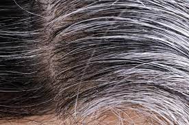 Another reason it could seem more rough? White Hair Causes And Ways To Prevent It