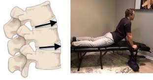 Image result for McKenzie Method