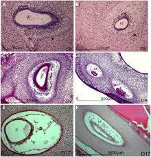 In this course, craig elliot, provides a breakdown of the female anatomy. Like A Hole In The Head Development Evolutionary Implications And Diseases Of The Cranial Foramina Sciencedirect