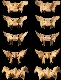 Image result for Sphenoid Bone
