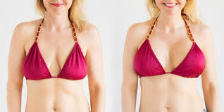 Dort soll er als henker dienen, doch die reise hält einige überraschungen für den jungen mann bereit: Bruststraffung In Winterthur Zurich Clinic Plastica