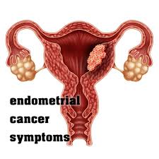 Symptoms of uterine cancer and uterine fibroids that are similar include pain or feeling of fullness in the abdomen or frequent urination. Endometrial Cancer Symptoms Risk Factors Stages Treatment