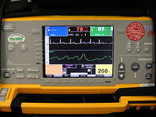 Septal positioning of ventricular implanted cardioverter defibrillator (icd) leads (spice) the safety and scientific validity of this study is the responsibility of the study sponsor and investigators. Defibrillator Wikipedia