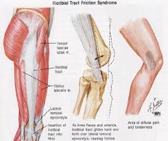Signs of itbs mostly appear if you increase the intensity of your physical poor pelvic stability as a cause of itbs it's common to see many runners with their lower legs strongly tilted inward. Is It Band Syndrome The Cause Of My Hip And Knee Pain The Knee Joint