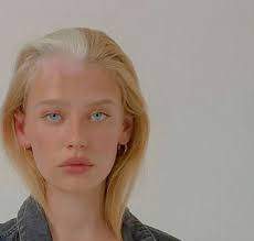 30 Beautiful Genetic Mutations In Humans Bemethis Human Pretty Face Beauty