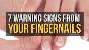 Visible changes in the skin can also be produced by some other types of cancers as well. 15 Health Warning Signs From Your Fingernails