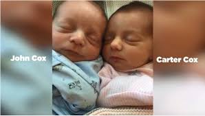 Startling these twins could put their hearts at risk